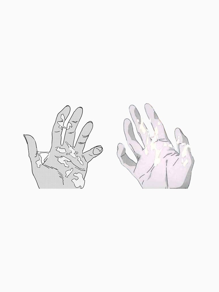 "Hospital scene" and "chp 168 ending" Hands by Danknesshazard